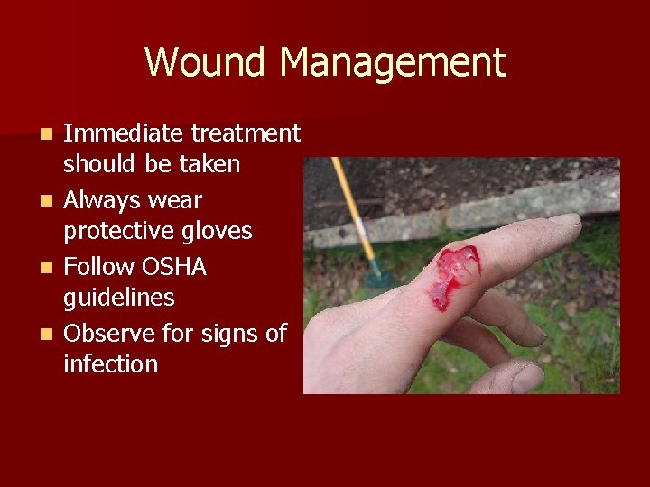 Wound Management n n Immediate treatment should be taken Always wear protective gloves Follow