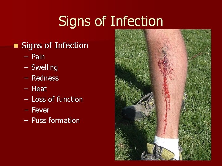 Signs of Infection n Signs of Infection – – – – Pain Swelling Redness