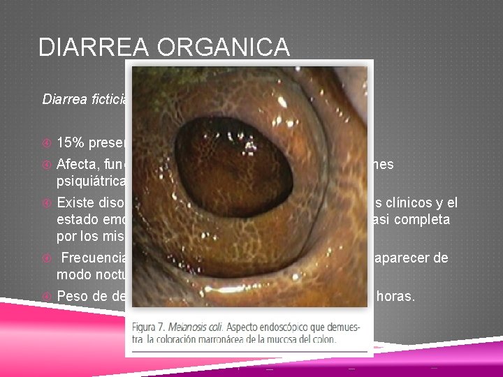 DIARREA ORGANICA Diarrea ficticia 15% presenta abuso de laxante. Afecta, fundamentalmente, a mujeres con