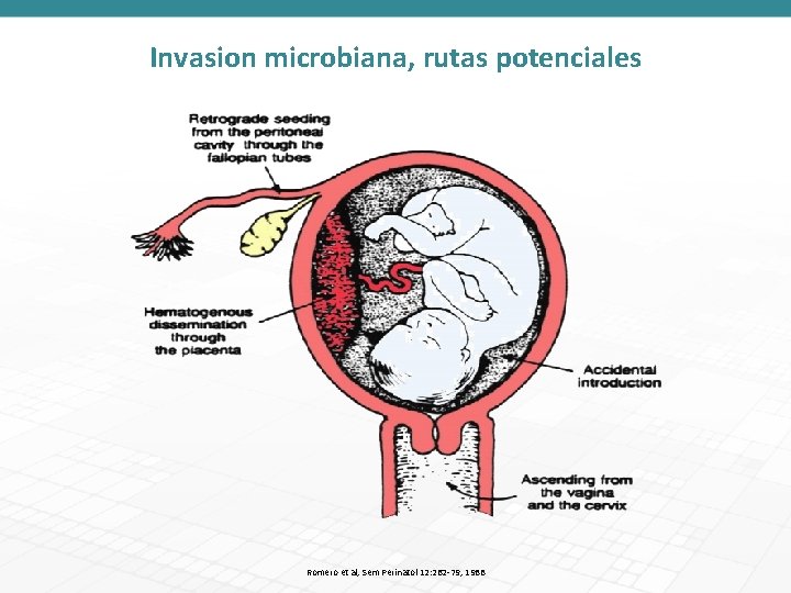 Invasion microbiana, rutas potenciales Romero et al, Sem Perinatol 12: 262 -79, 1988 