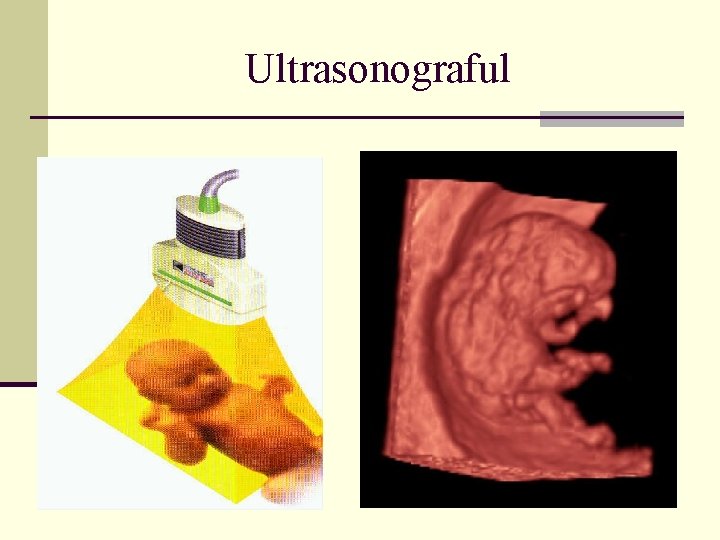 Ultrasonograful 