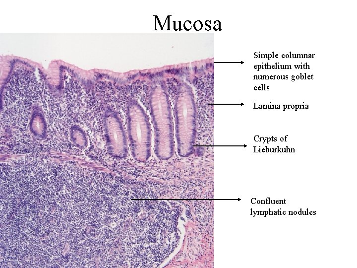 Mucosa Simple columnar epithelium with numerous goblet cells Lamina propria Crypts of Lieburkuhn Confluent