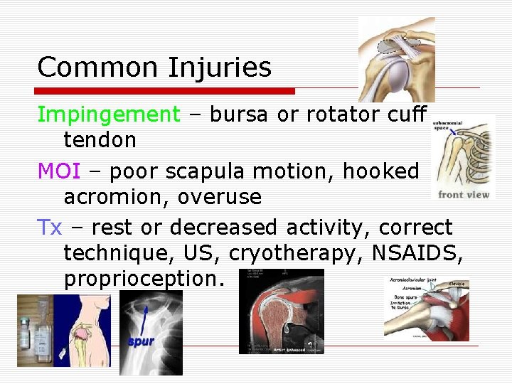 Common Injuries Impingement – bursa or rotator cuff tendon MOI – poor scapula motion,
