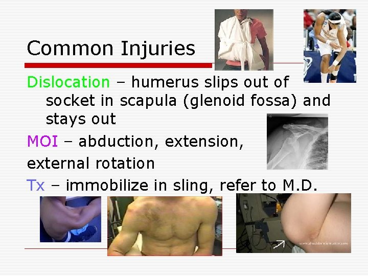 Common Injuries Dislocation – humerus slips out of socket in scapula (glenoid fossa) and