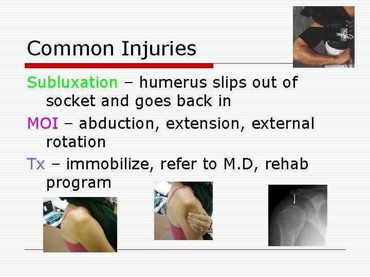 Common Injuries Subluxation – humerus slips out of socket and goes back in MOI