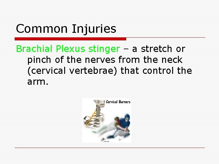 Common Injuries Brachial Plexus stinger – a stretch or pinch of the nerves from