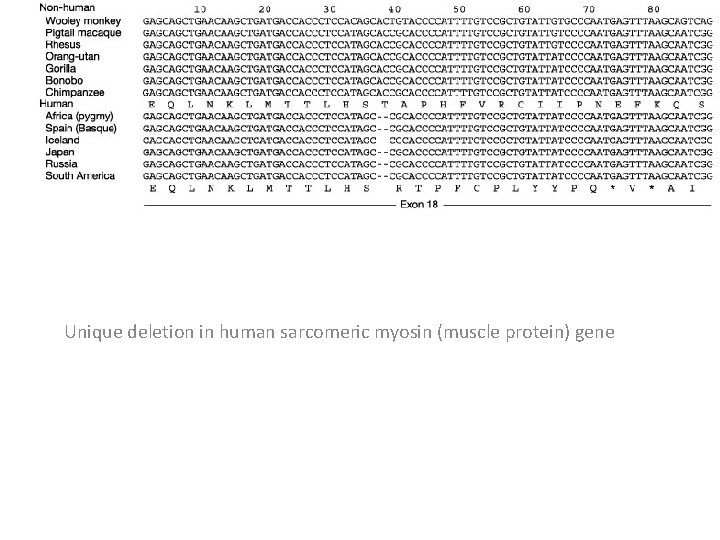 Unique deletion in human sarcomeric myosin (muscle protein) gene 
