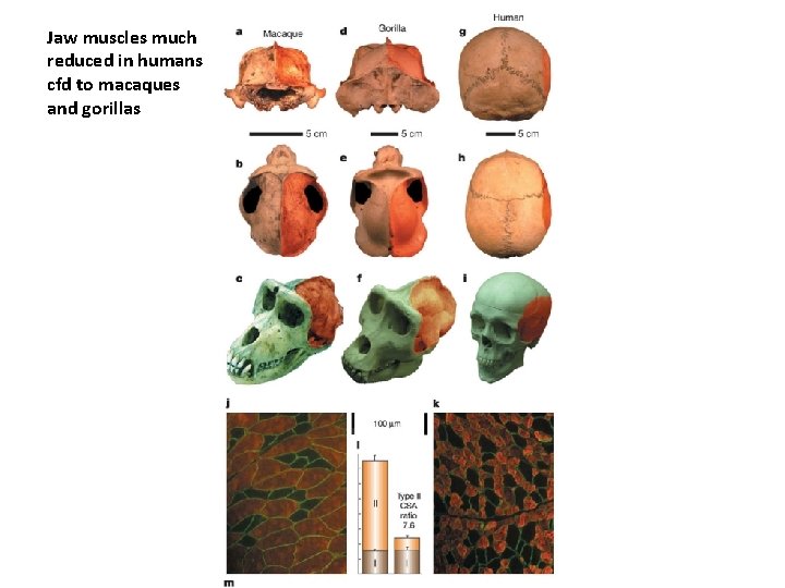 Jaw muscles much reduced in humans cfd to macaques and gorillas 