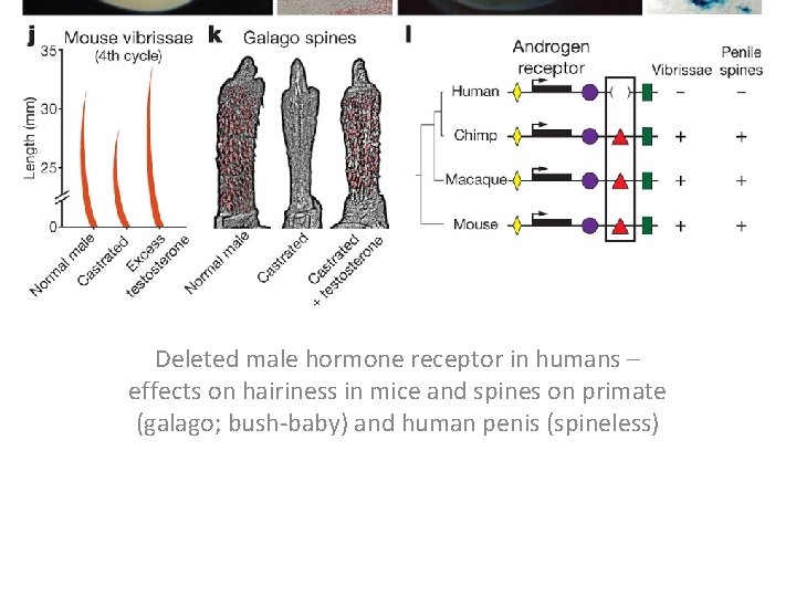 Deleted male hormone receptor in humans – effects on hairiness in mice and spines