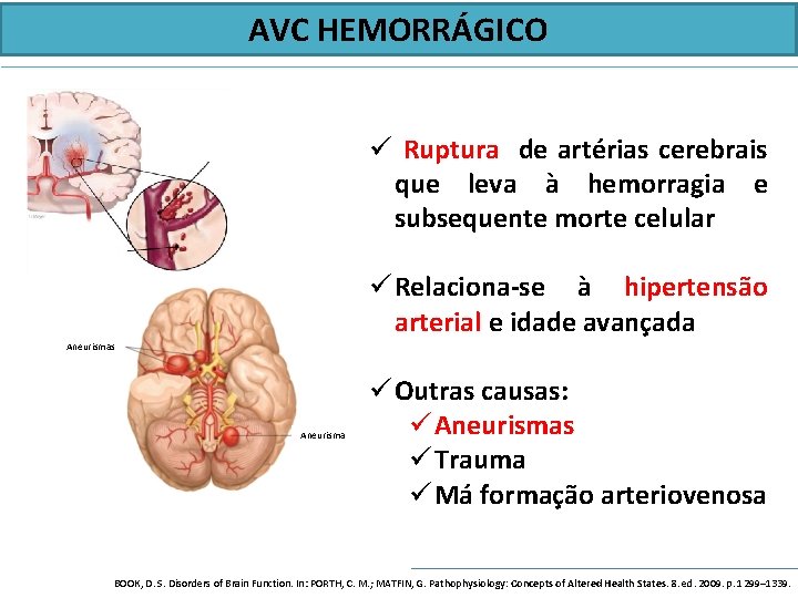 AVC HEMORRÁGICO ü Ruptura de artérias cerebrais que leva à hemorragia e subsequente morte