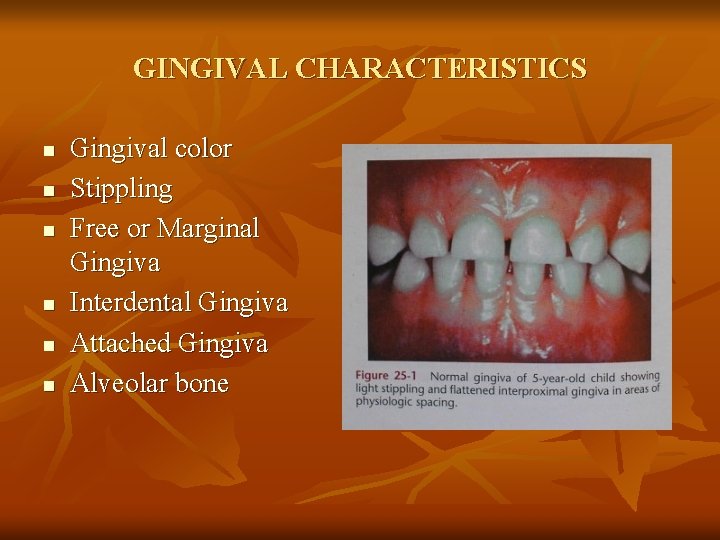 GINGIVAL CHARACTERISTICS n n n Gingival color Stippling Free or Marginal Gingiva Interdental Gingiva