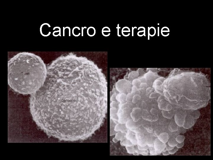 Cancro e terapie Cancro e terapie