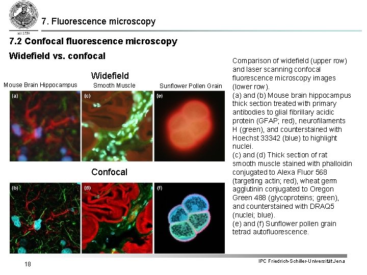 7. Fluorescence microscopy 7. 2 Confocal fluorescence microscopy Widefield vs. confocal Widefield Mouse Brain