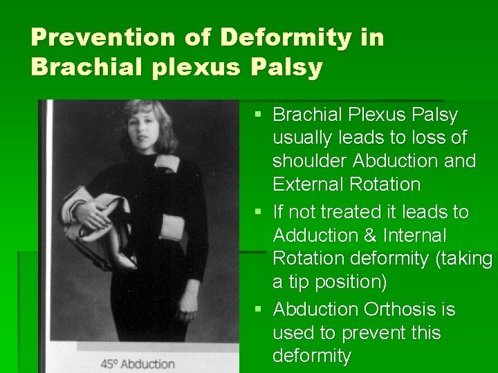 Prevention of Deformity in Brachial plexus Palsy § Brachial Plexus Palsy usually leads to