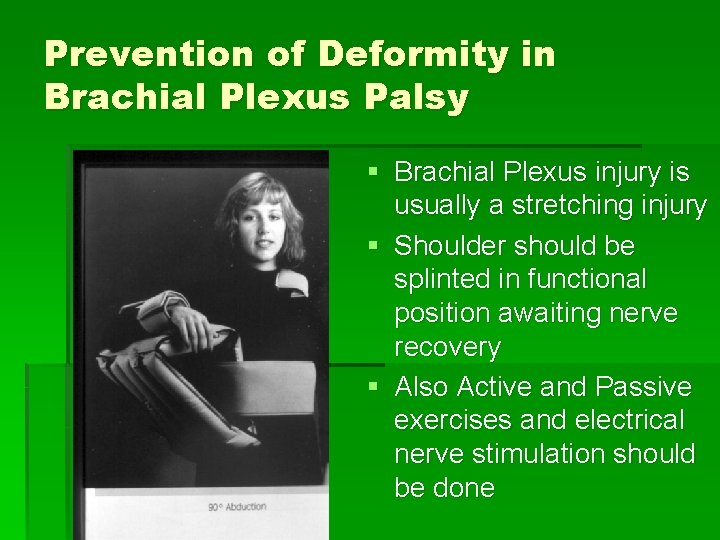 Prevention of Deformity in Brachial Plexus Palsy § Brachial Plexus injury is usually a