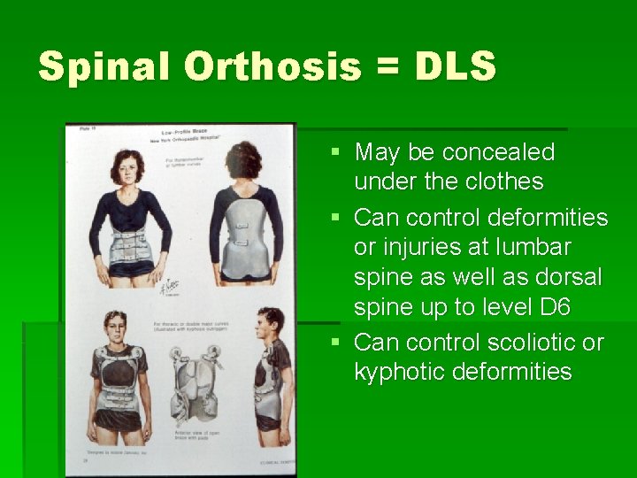 Spinal Orthosis = DLS § May be concealed under the clothes § Can control