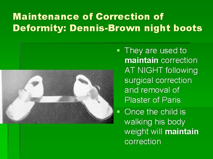 Maintenance of Correction of Deformity: Dennis-Brown night boots § They are used to maintain