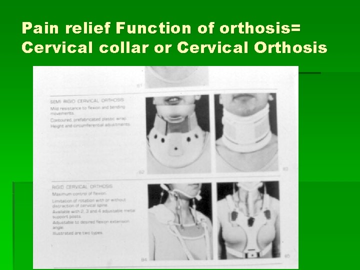 Pain relief Function of orthosis= Cervical collar or Cervical Orthosis 