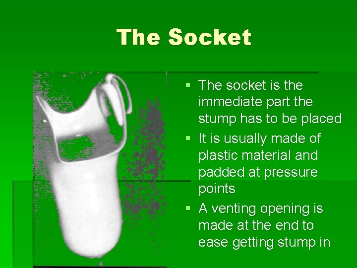 The Socket § The socket is the immediate part the stump has to be