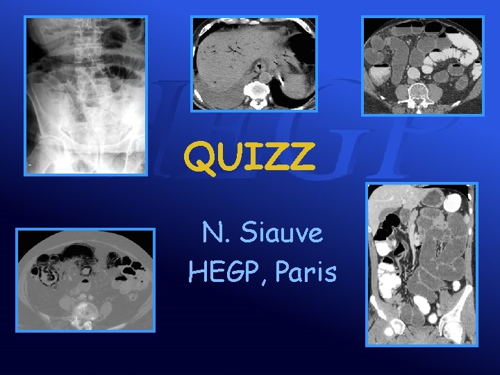 QUIZZ N. Siauve HEGP, Paris 