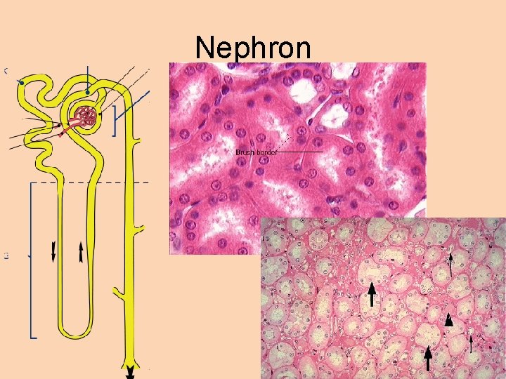 Nephron 