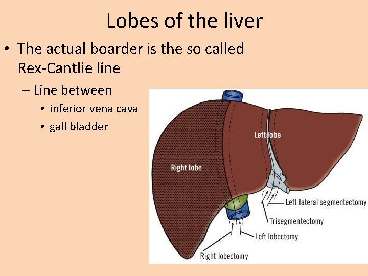 Lobes of the liver • The actual boarder is the so called Rex-Cantlie line