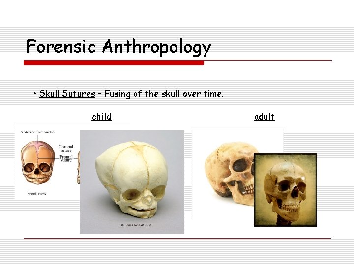 Forensic Anthropology • Skull Sutures – Fusing of the skull over time. child adult