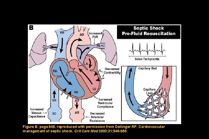 Figure B, page 948, reproduced with permission from Dellinger RP. Cardiovascular management of septic