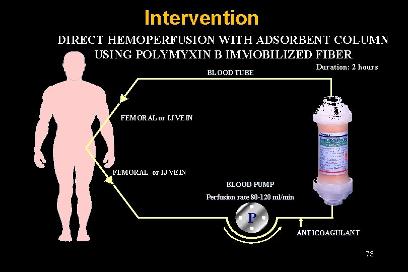 Intervention DIRECT HEMOPERFUSION WITH ADSORBENT COLUMN USING POLYMYXIN B IMMOBILIZED FIBER BLOOD TUBE Duration: