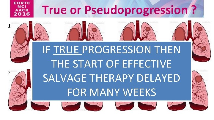 True or Pseudoprogression ? 1 2 IF TRUE PROGRESSION THE START OF EFFECTIVE SALVAGE