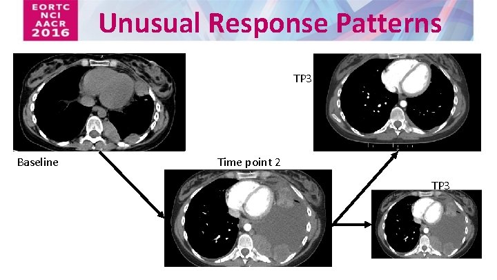 Unusual Response Patterns TP 3 Baseline Time point 2 TP 3 