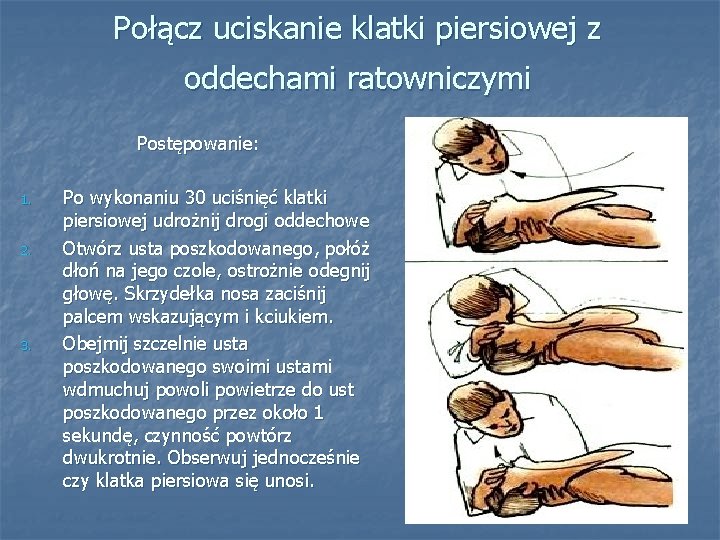 Połącz uciskanie klatki piersiowej z oddechami ratowniczymi Postępowanie: 1. 2. 3. Po wykonaniu 30