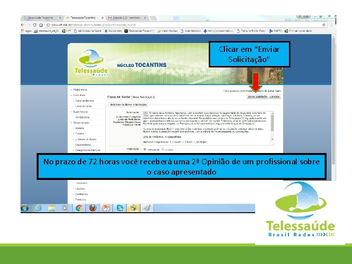 Clicar em “Enviar Solicitação” No prazo de 72 horas você receberá uma 2ª Opinião