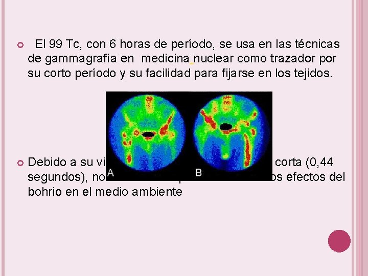  El 99 Tc, con 6 horas de período, se usa en las técnicas