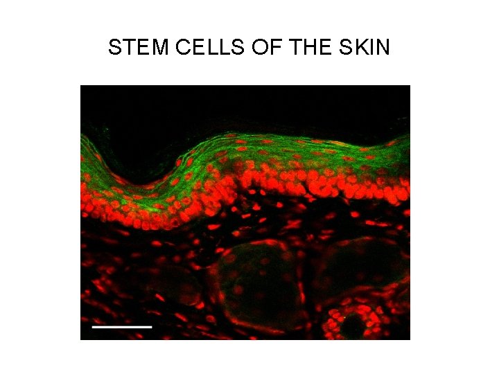 STEM CELLS OF THE SKIN 