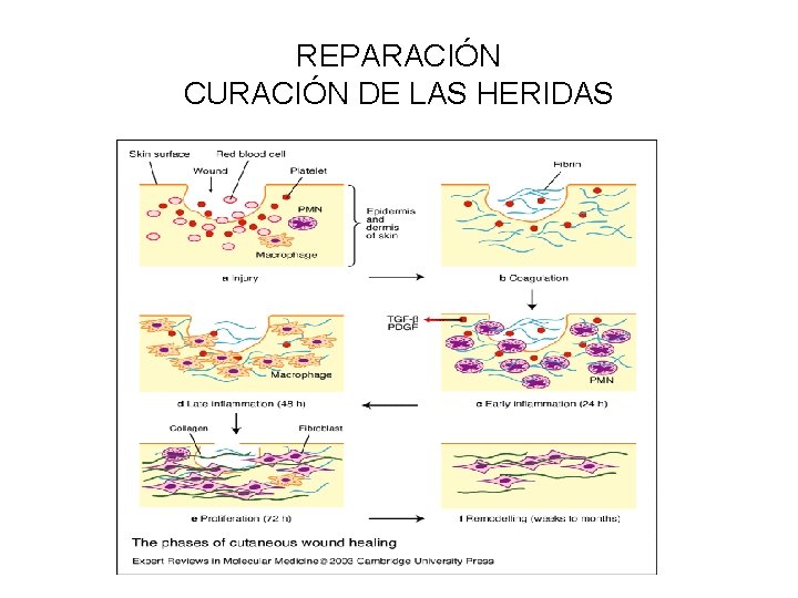 REPARACIÓN CURACIÓN DE LAS HERIDAS 