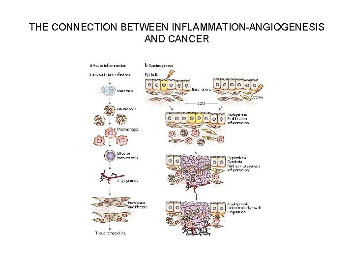THE CONNECTION BETWEEN INFLAMMATION-ANGIOGENESIS AND CANCER 