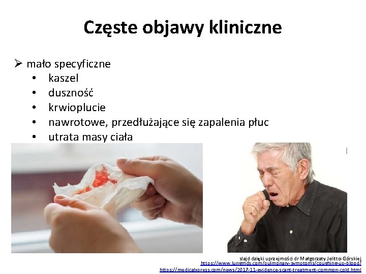 Częste objawy kliniczne Ø mało specyficzne • kaszel • duszność • krwioplucie • nawrotowe,