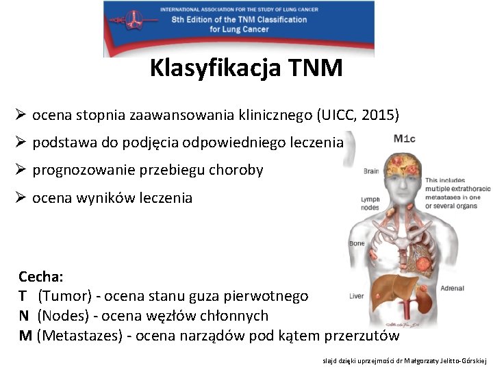 Klasyfikacja TNM Ø ocena stopnia zaawansowania klinicznego (UICC, 2015) Ø podstawa do podjęcia odpowiedniego