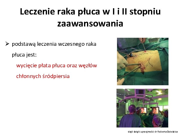 Leczenie raka płuca w I i II stopniu zaawansowania Ø podstawą leczenia wczesnego raka