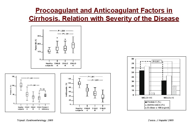 Procoagulant and Anticoagulant Factors in Cirrhosis. Relation with Severity of the Disease Tripodi. Gastroenterology.