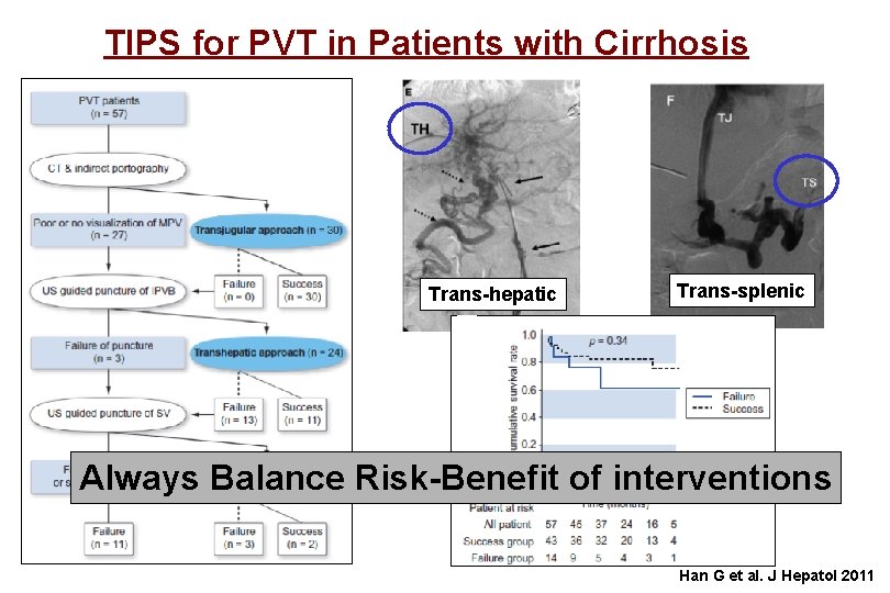 TIPS for PVT in Patients with Cirrhosis Trans-hepatic Trans-splenic Always Balance Risk-Benefit of interventions