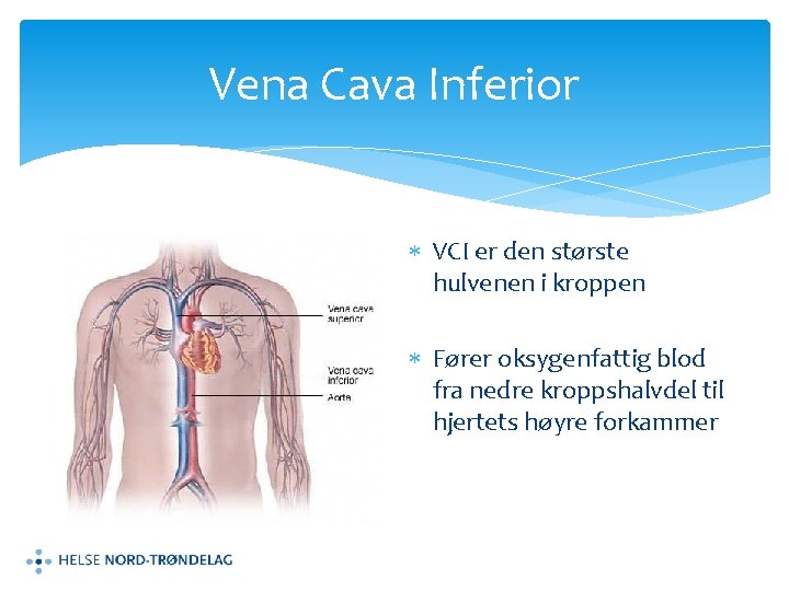 Vena Cava Inferior VCI er den største hulvenen i kroppen Fører oksygenfattig blod fra