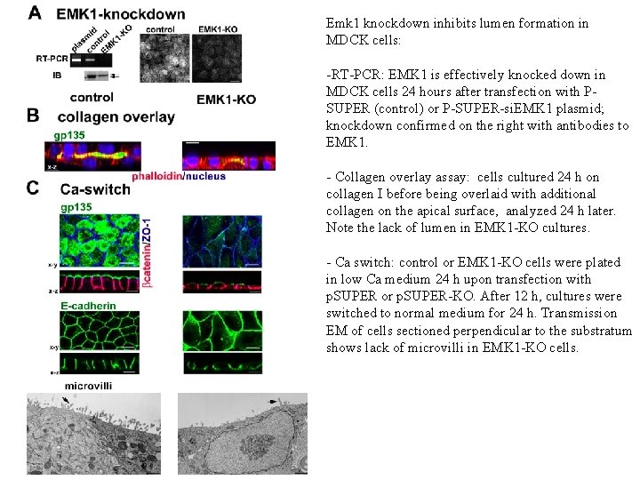 Emk 1 knockdown inhibits lumen formation in MDCK cells: -RT-PCR: EMK 1 is effectively