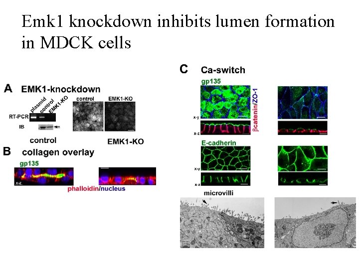 Emk 1 knockdown inhibits lumen formation in MDCK cells 