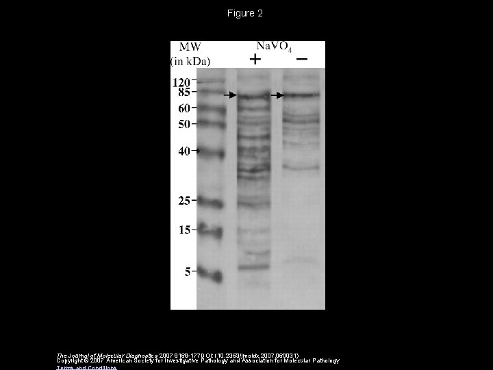 Figure 2 The Journal of Molecular Diagnostics 2007 9169 -177 DOI: (10. 2353/jmoldx. 2007.