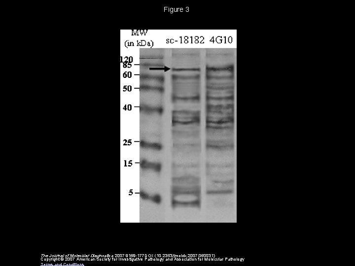 Figure 3 The Journal of Molecular Diagnostics 2007 9169 -177 DOI: (10. 2353/jmoldx. 2007. Figure 3 The Journal of Molecular Diagnostics 2007 9169 -177 DOI: (10. 2353/jmoldx. 2007.