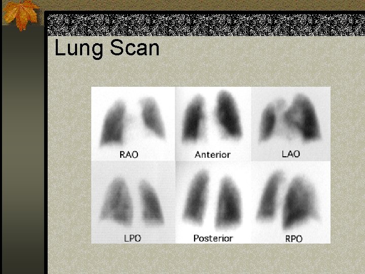 Lung Scan 