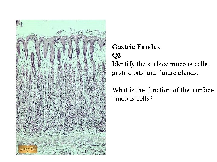 Gastric Fundus Q 2 Identify the surface mucous cells, gastric pits and fundic glands.