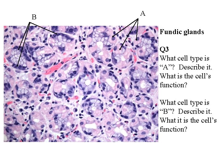 B A Fundic glands Q 3 What cell type is “A”? Describe it. What